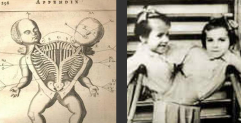 Josef Mengele je známý svými ohavnými experimenty. Toto byly jeho